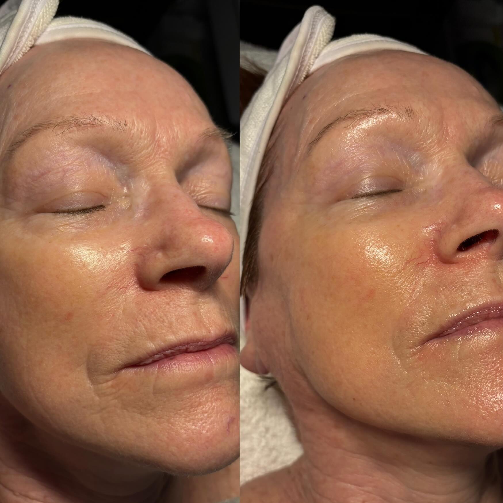 Detail — glowing skin