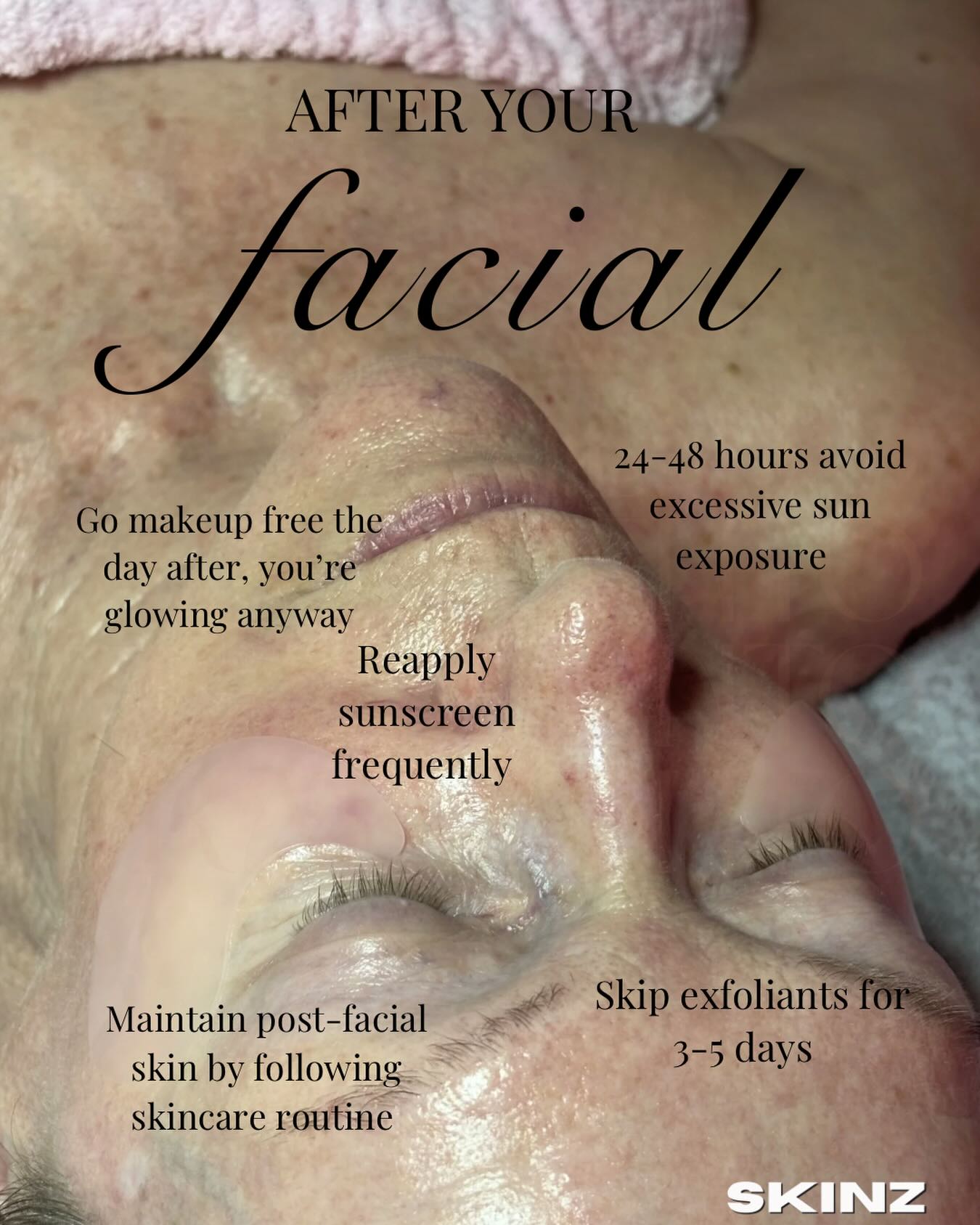 Is Dermaplaning Safe? Myths vs. Facts From My Treatment Room